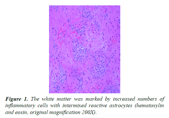 pathology-disease-biology-reactive-astrocytes