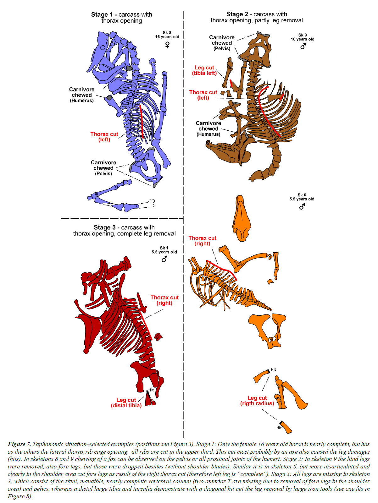 pathology-disease-biology-thorax-rib