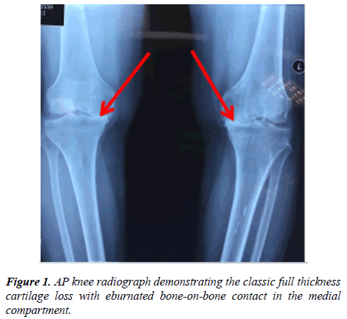 physical-therapy-sports-medicine-knee-radiograph