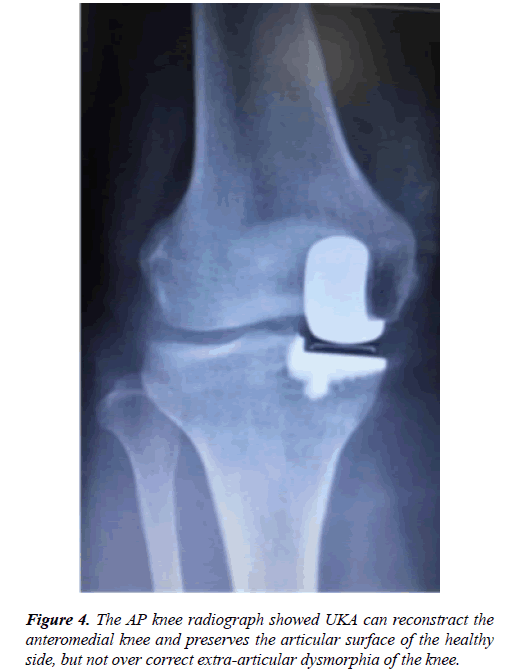 physical-therapy-sports-medicine-knee-radiograph