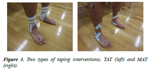 physical-therapy-sports-medicine-taping-interventions