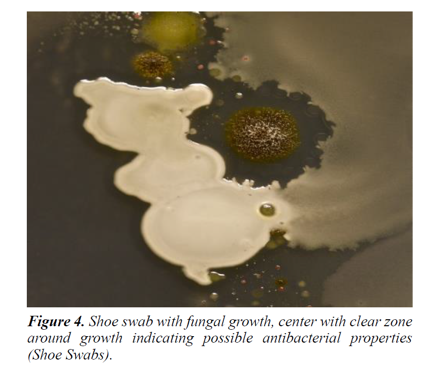 plant-biotechnology-microbiology-fungal-growth