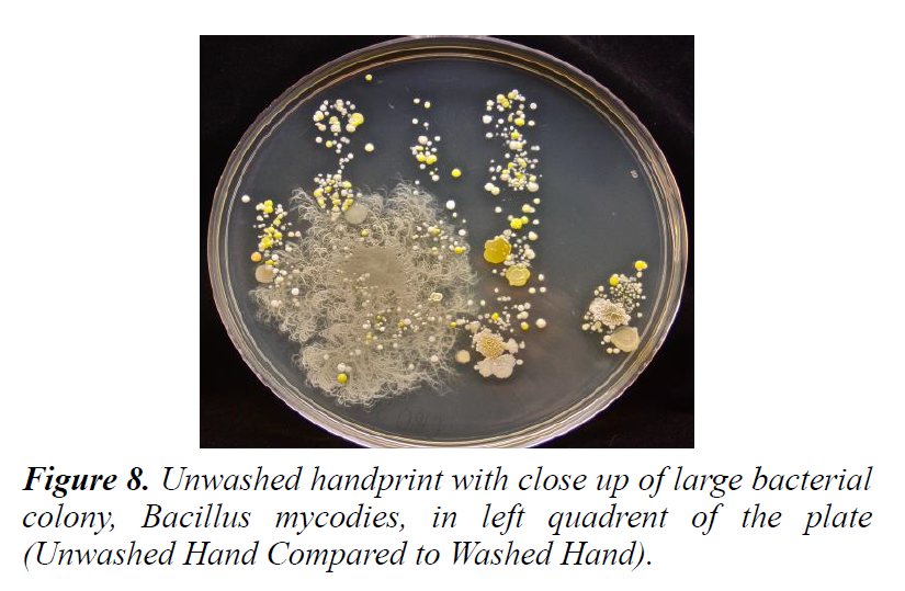 plant-biotechnology-microbiology-unwashed-handprint