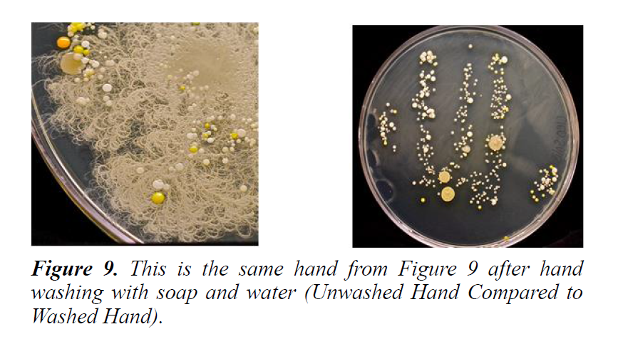 plant-biotechnology-microbiology-unwashed-handprint