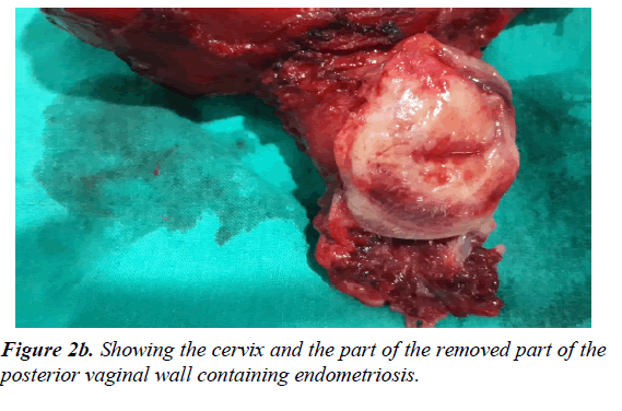 pregnancy-and-neonatal-medicine-cervix