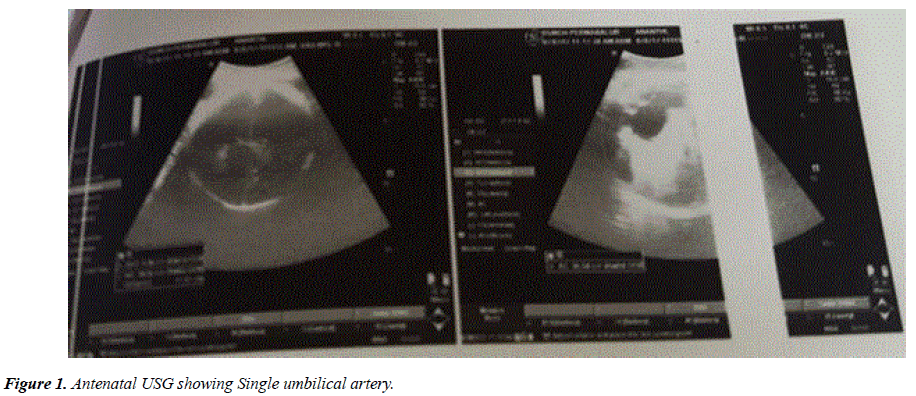 pregnancy-neonatal-medicine-Antenatal-USG