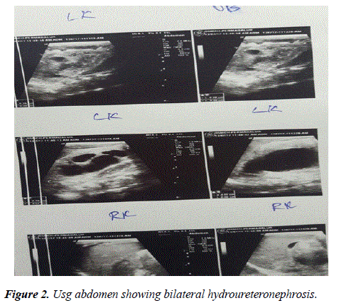 pregnancy-neonatal-medicine-Usg-abdomen