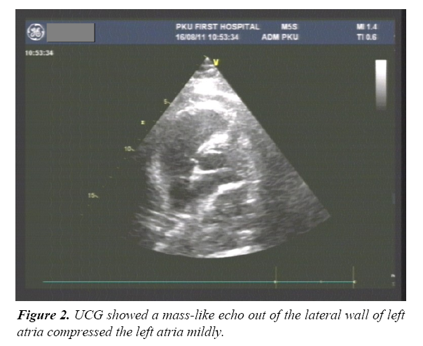 pulmonology-clinical-research-mass-like-echo