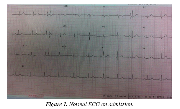 pulmonology-clinical-research-normal-ECG