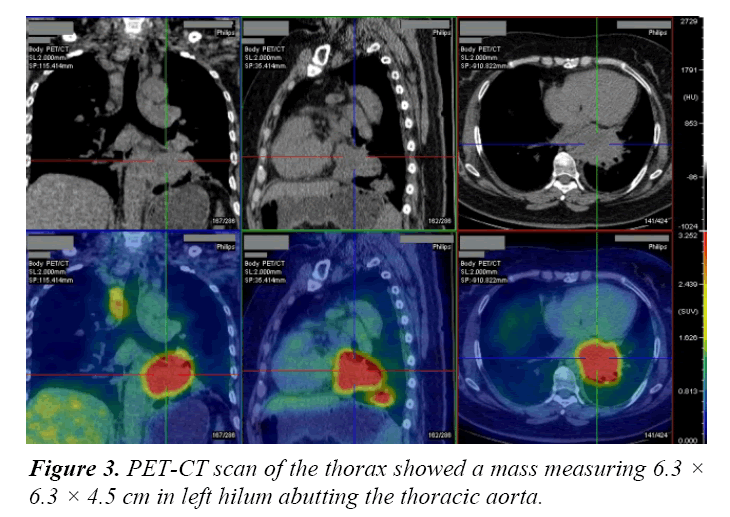 pulmonology-clinical-research-thoracic-aorta