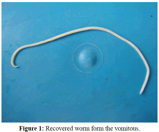 pure-applied-zoology-Recovered-worm