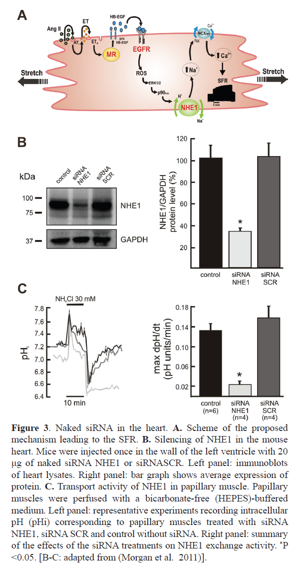 rnai-gene-silencing-papillary-muscle