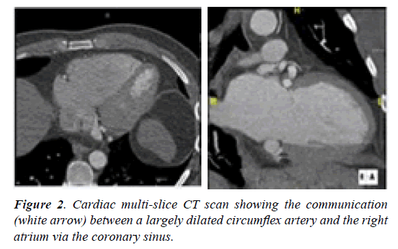 surgery-invasive-procedures-Cardiac-multi-slice