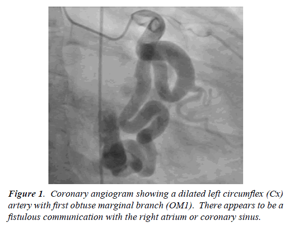 surgery-invasive-procedures-Coronary-angiogram