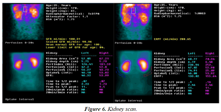 surgery-invasive-procedures-Kidney-scan