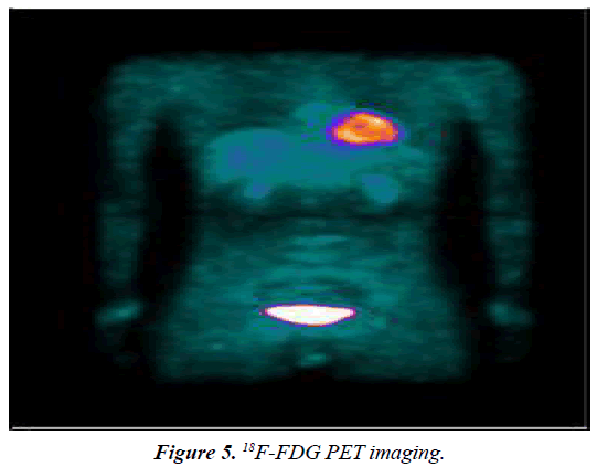 surgery-invasive-procedures-PET-imaging