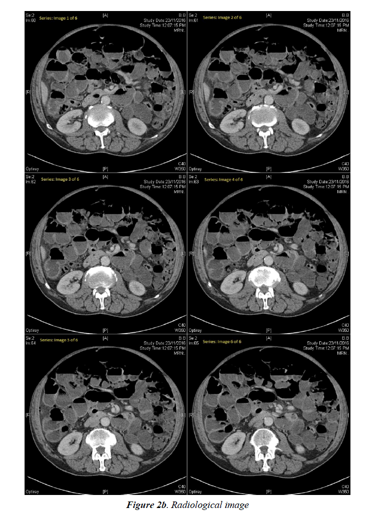 surgery-invasive-procedures-Radiological