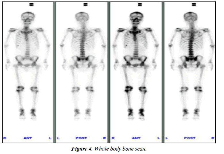 surgery-invasive-procedures-Whole-body