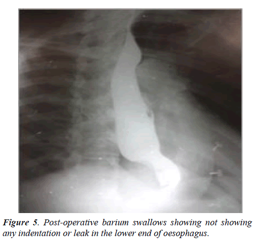 surgery-invasive-procedures-barium-swallows