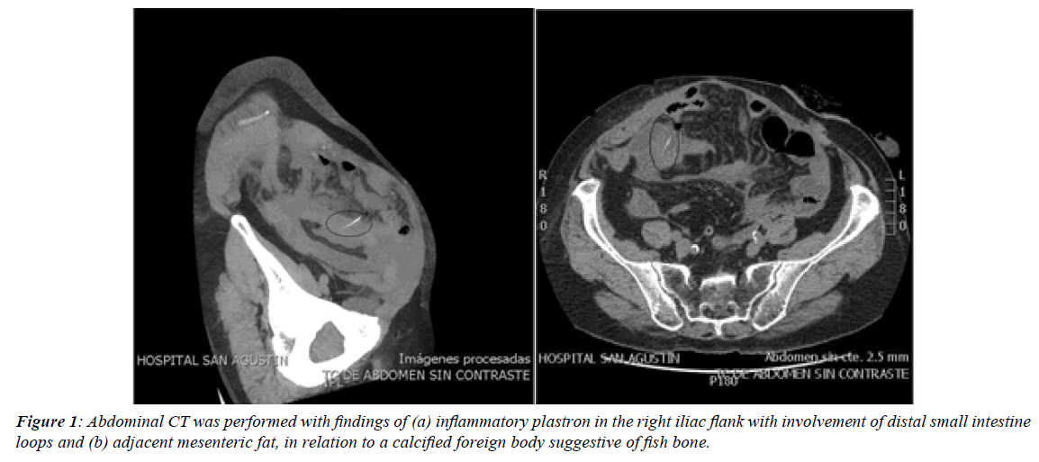 surgery-invasive-procedures-inflammatory-plastron