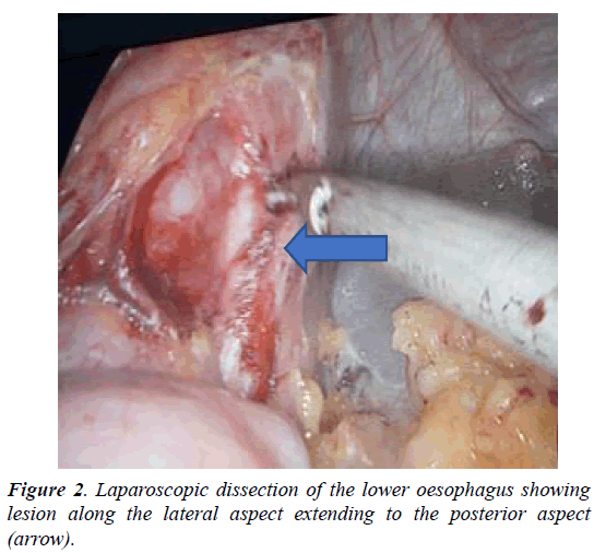 surgery-invasive-procedures-posterior-aspect