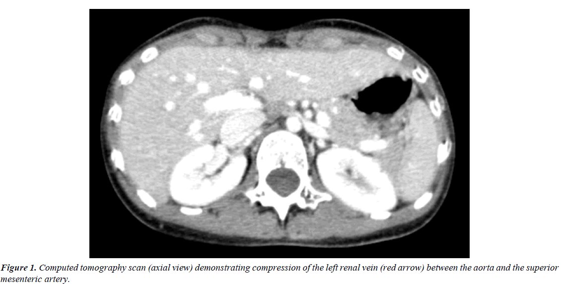 surgery-invasive-procedures-tomography-scan