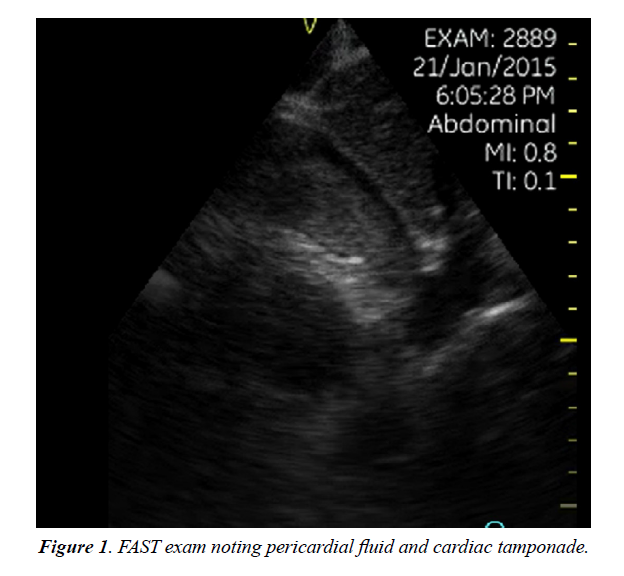 trauma-critical-care-cardiac-tamponade