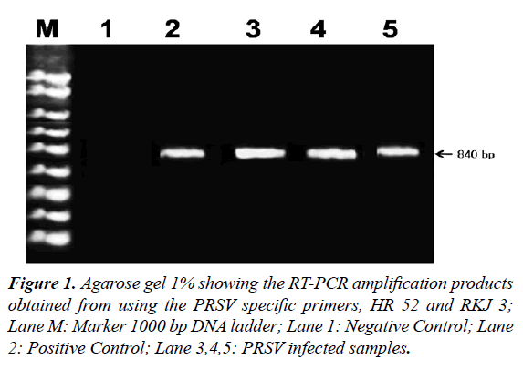 virology-research-Agarose-gel